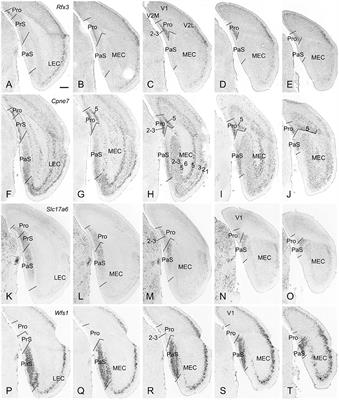 Homotopic Commissural Projections of Area Prostriata in Rat and Mouse: Comparison With Presubiculum and Parasubiculum